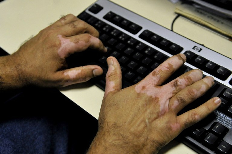 Fatores emocionais podem desencadear ou agravar a ocorrência
Arquivo/ Agência Brasil